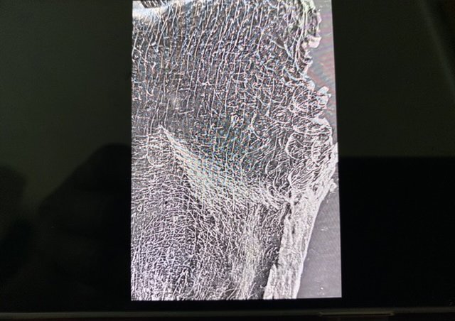 Papier-mâché skin cast