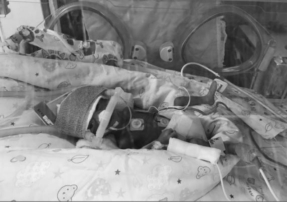 A newborn baby in a incubator