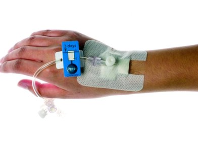 Design Bugs Out: Cannula with Self-timing Indicator