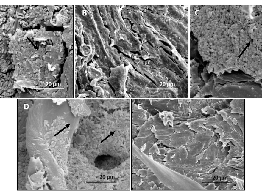 Surface of BT Cotton Seeds, Electron Microscopy Scan