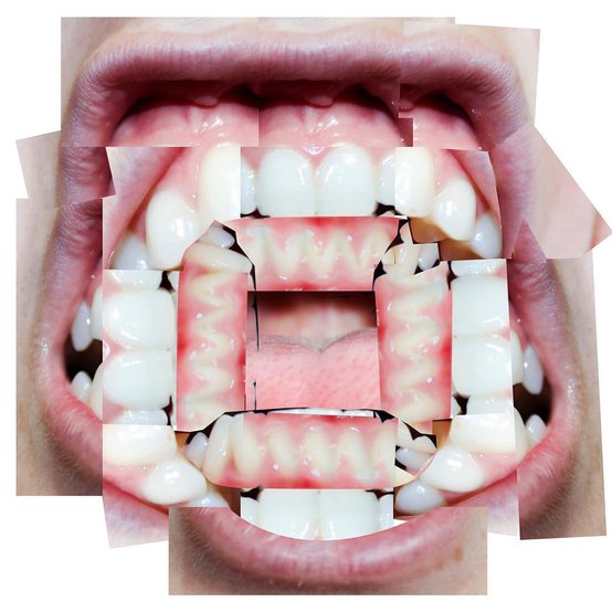 Teeths